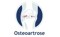 Osteoartrose